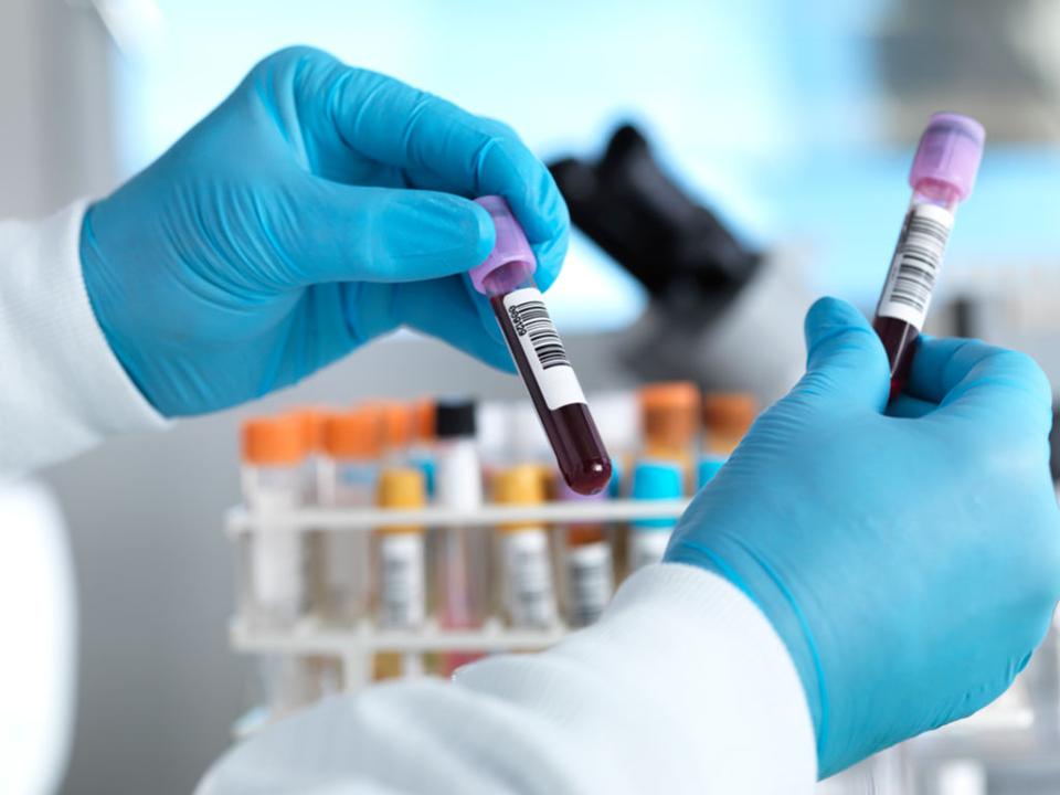 Nigeria records 51 new cases of coronavirus in one day 5 Two New labs activated for COVID-19 testing in Nigeria Nigeria records 51 new cases coronavirus in one day