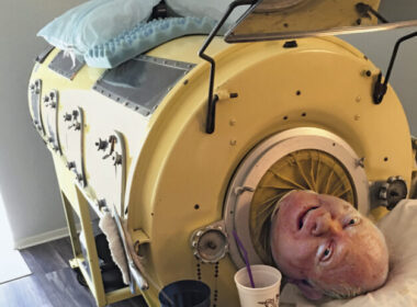 Iron Lung Survivor Paul Alexander Passes Away at 78: A Life of Resilience and Achievement