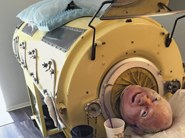 Iron Lung Survivor Paul Alexander Passes Away at 78: A Life of Resilience and Achievement
