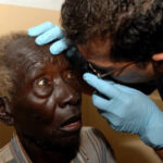 1.1m Nigerians Over 40 Visually Impaired
