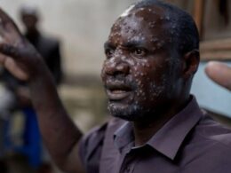 Mpox Declared Public Health Emergency after 450 deaths