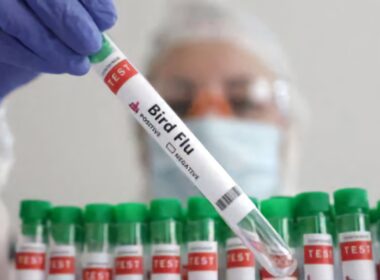 First Human Bird Flu Case in US Without Animal Exposure Confirmed