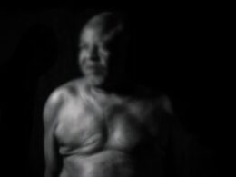 Men Can Get Breast Cancer Too – UITH CMD Issues Urgent Warning