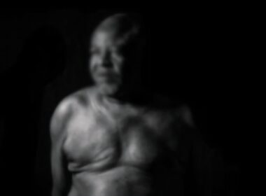 Men Can Get Breast Cancer Too – UITH CMD Issues Urgent Warning