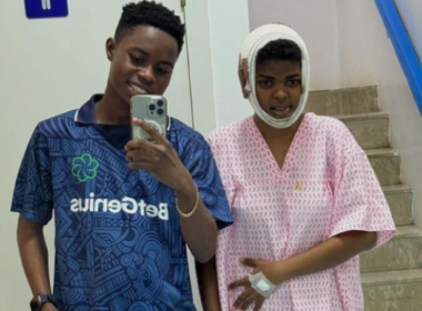 Popular TikToker, Jarvis undergoes jaw tumour surgery