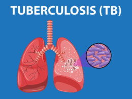 WHO Prequalifies Groundbreaking Tuberculosis Test