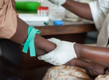 Rivers, Benue, Akwa Ibom Lead Nigeria’s HIV Burden as Over Two Million Live with Virus